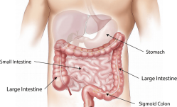 Colonics: Pros and Cons