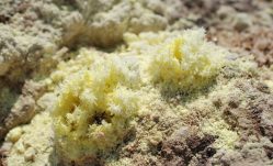 Sulfur and Skin Care