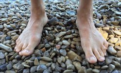 Simple Ways to Treat Plantar Fasciitis Naturally